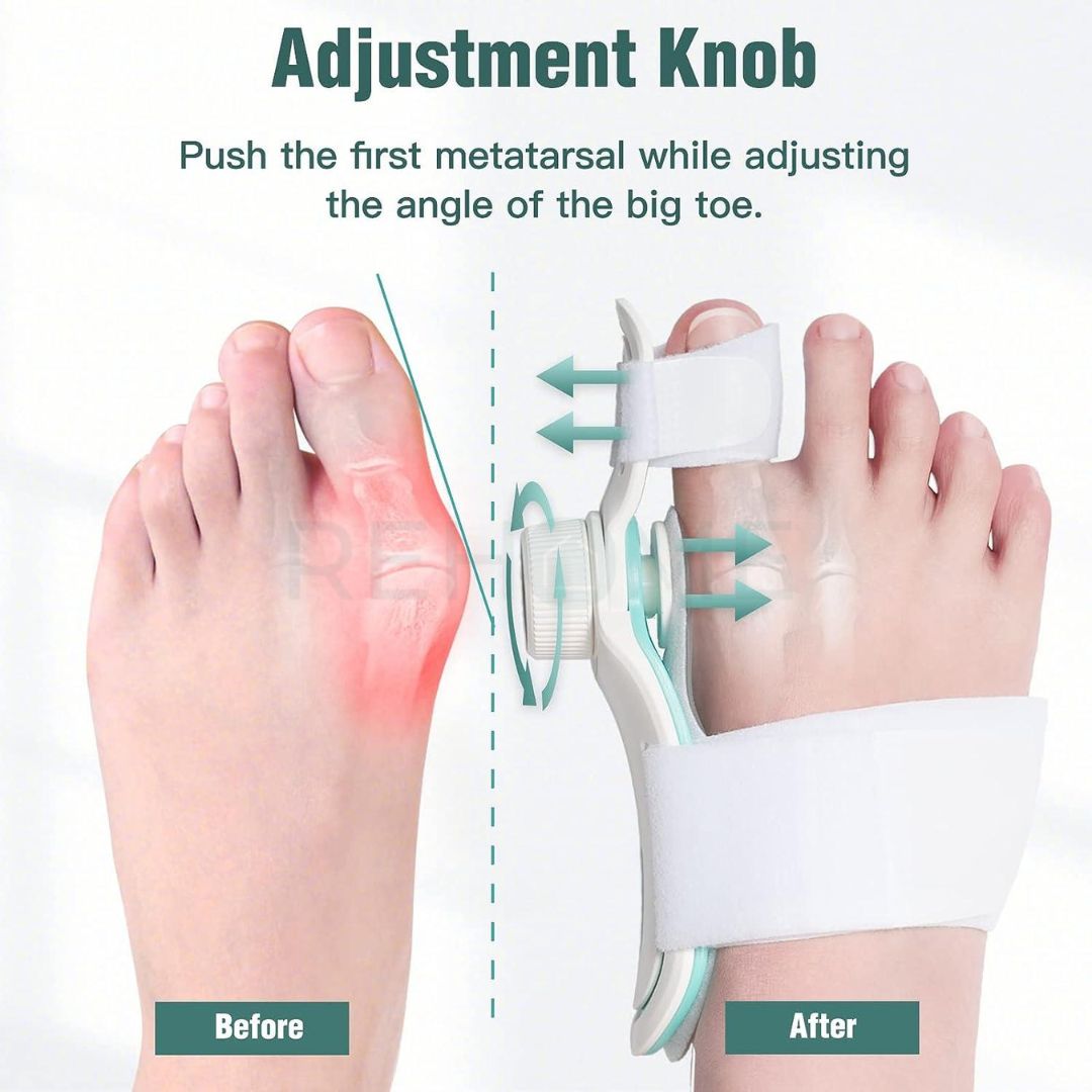 Pain Relief Bunion Toe Corrector