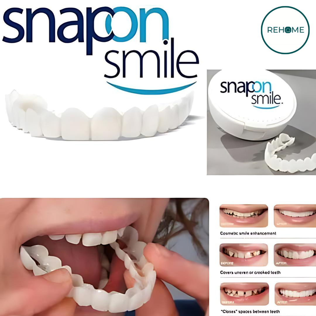 Snap on Smile Teeth Veneer Braces - (IMPORTED) – REHOME