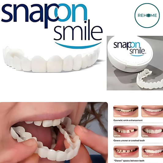 Snap on Smile Teeth Veneer Braces - (IMPORTED)