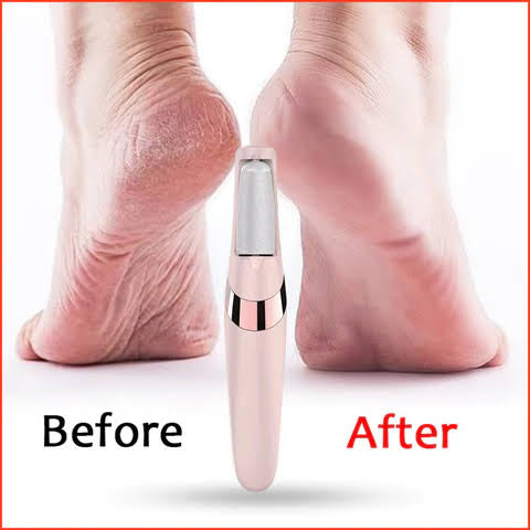 Flawless Pedi Callus Remover